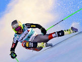 Ted Ligety operisao šaku